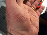 IMG_3491GTBiteBaseOfThumb.jpg