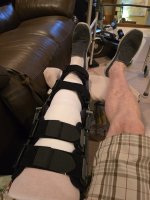 Leg brace 9-24.jpg